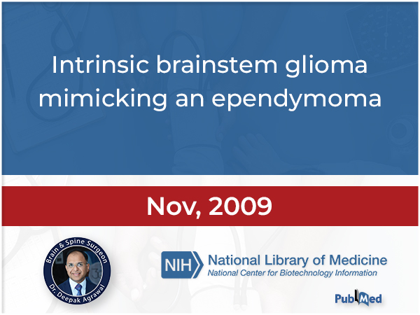 Intrinsic brainstem glioma mimicking an ependymoma