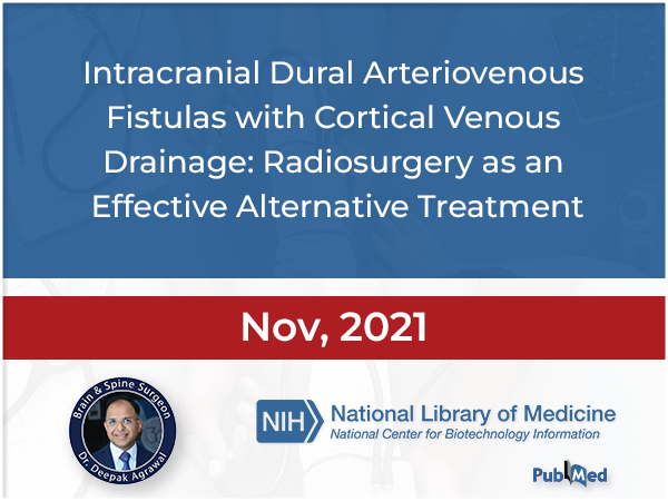 Intracranial Dural Arteriovenous Fistulas with Cortical Venous Drainage: Radiosurgery as an effective alternative treatment.