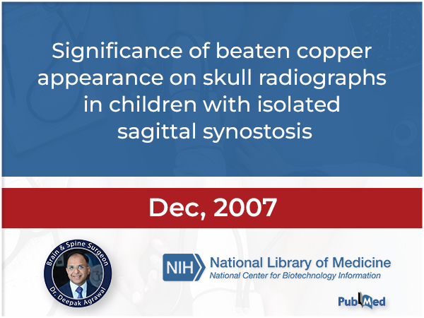 Significance of Beaten Copper Appearance on Skull Radiographs in Children with Isolated Sagittal Synostosis