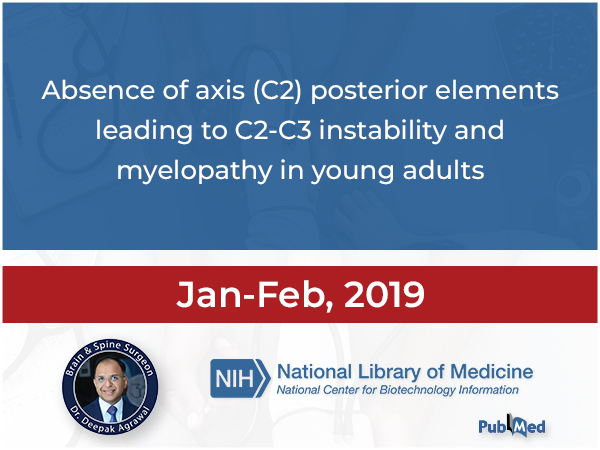 Absence of axis (C2) posterior elements leading to C2-C3 instability and myelopathy in young adults