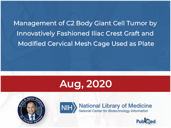 Management of C2 Body Giant Cell Tumor by Innovatively Fashioned Iliac Crest Graft and Modified Cervical Mesh Cage used as Plate.