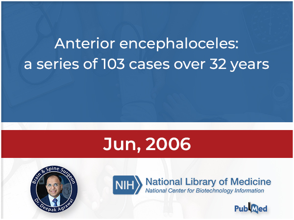 Anterior encephaloceles- a series 103 cases over 32 years