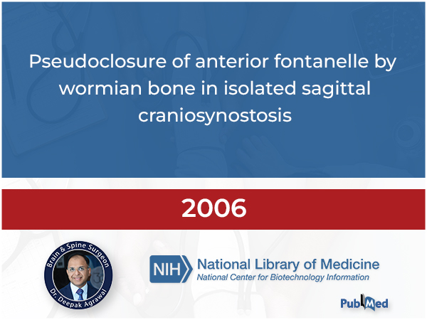 Pseudo-closure of Anterior Fontanelle by Wormian Bone in Isolated Sagittal Craniosynostosis