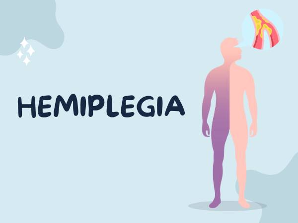 Hemiplegia_ Types, Causes, Symptoms & Treatment