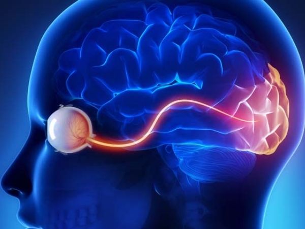 What is Neuritis_ Types, Causes and Symptoms