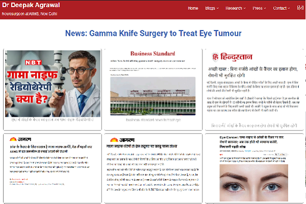 News Gamma Knife Surgery to Treat Eye Tumour