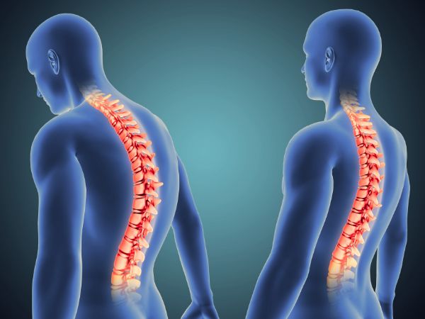 An Innovative Approach for Treating Complete Cervical Spinal Cord Injury_ Expansive Duraplasty
