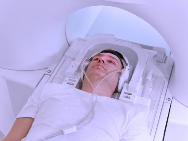 Gamma Knife Radiosurgery for Spetzler-Martin Grade III Cerebral Arterio-Venous Malformations