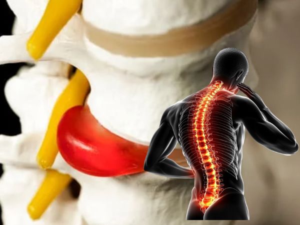 The vertebral artery_ what is it