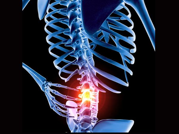What health effects might vertebral artery dissection have