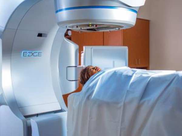Radiosurgery with Gamma Knife for Parasagittal_Parafalcine Meningiomas