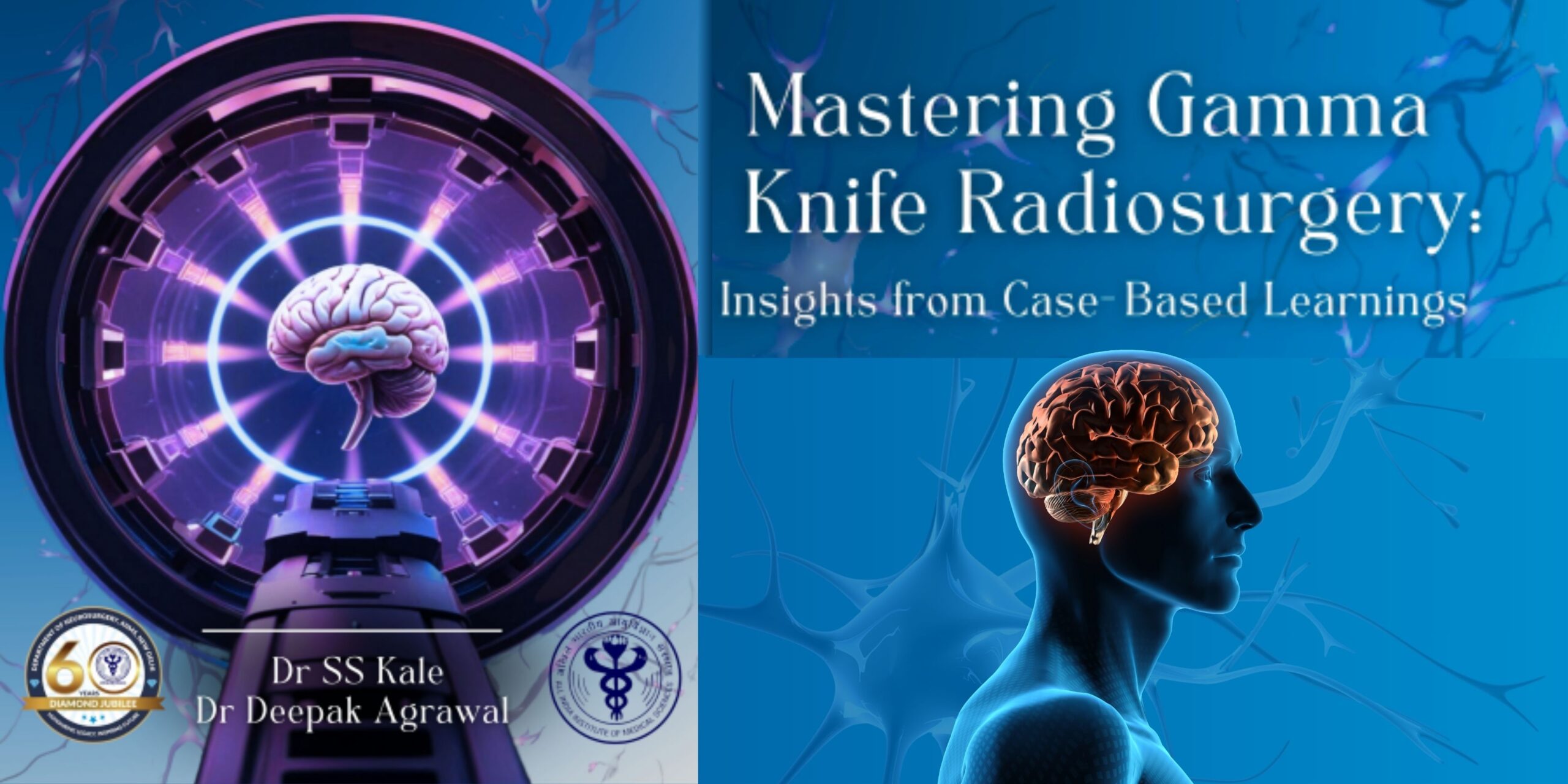 Mastering Gamma Knife Radiosurgery Banner