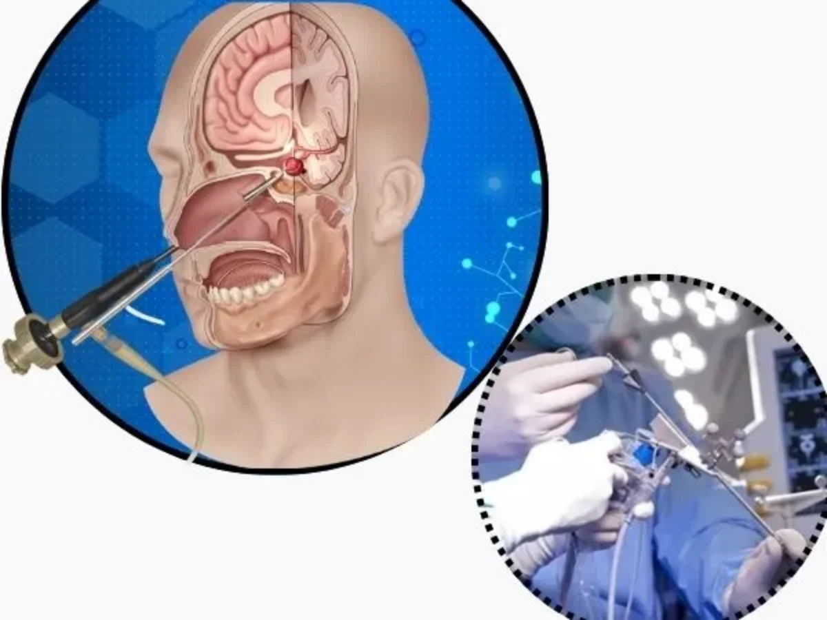 Minimally Invasive Brain Surgery: Benefits, Risks & Recovery - Dr