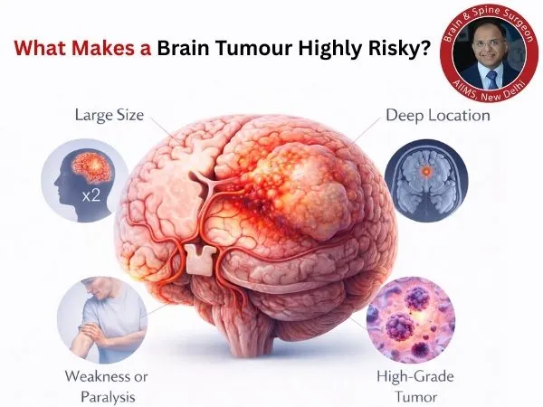 High-risk brain tumor explained visually