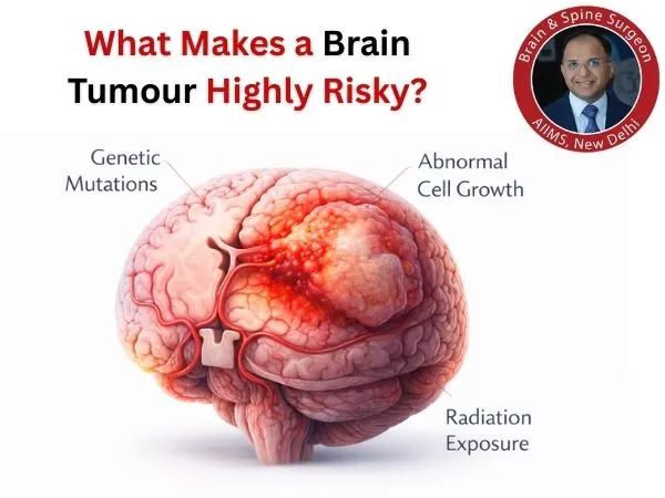 Severe brain tumor cross-section illustration