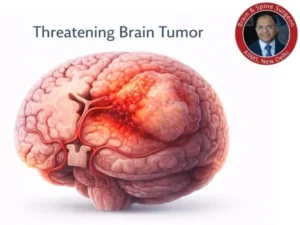 Threatening brain tumor details