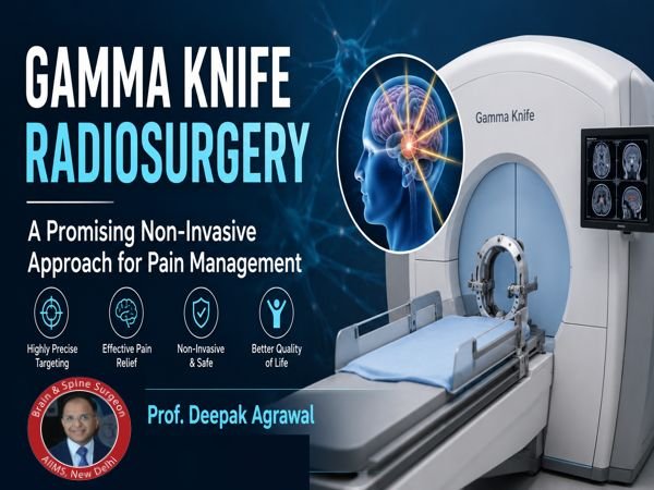Gamma Knife Treatment