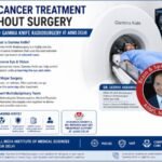 Gamma Knife eye cancer treatment at AIIMS