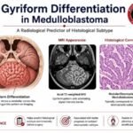 Gyriform Differentiation in Medulloblastoma