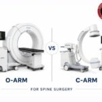 O-arm vs C-arm comparison for spine surgery