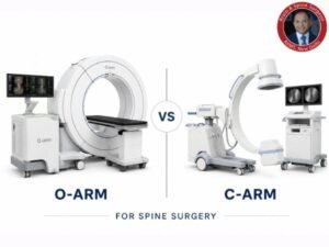 O-arm vs C-arm comparison for spine surgery