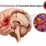 RANTES Biomarker in TBI