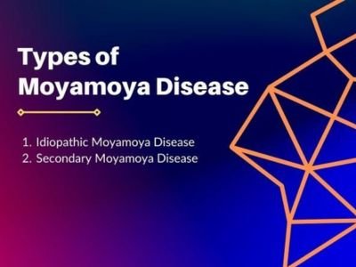Types-of-Moyamoya-Disease