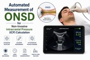 Automated ONSD measurement