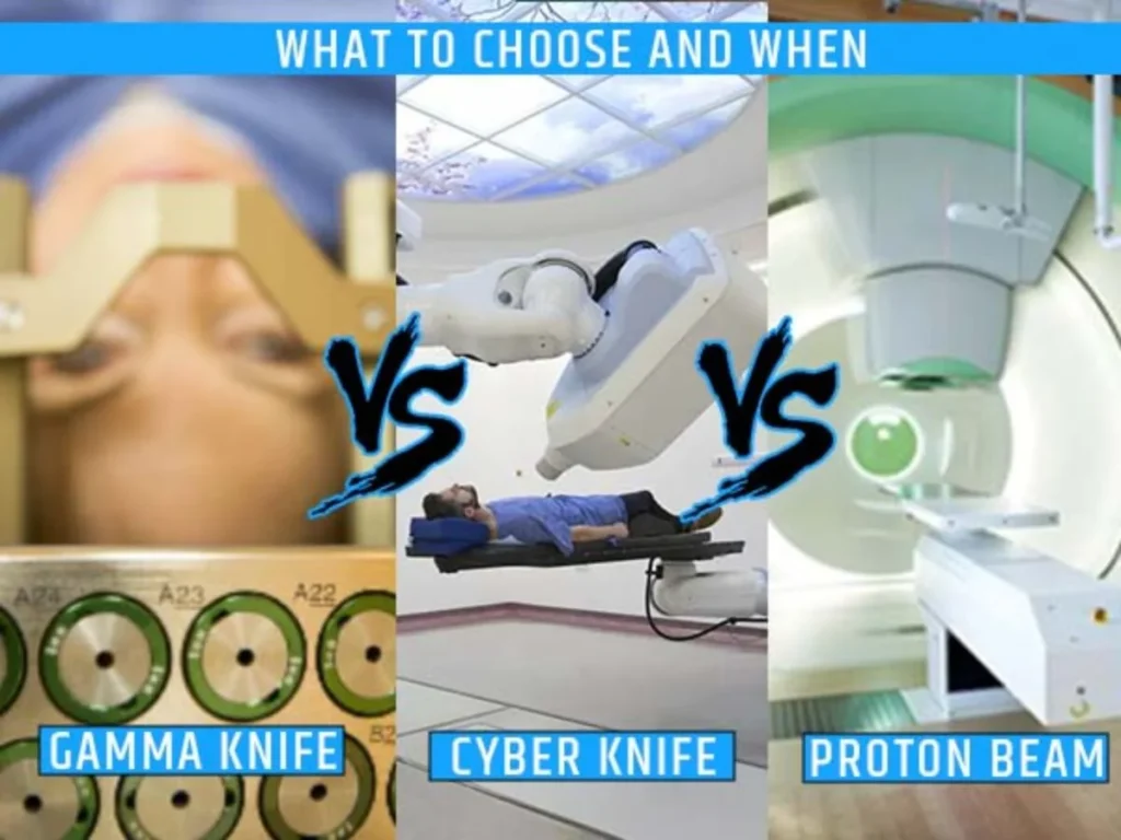 Gamma Knife vs Proton Beam vs CyberKnife Comparison